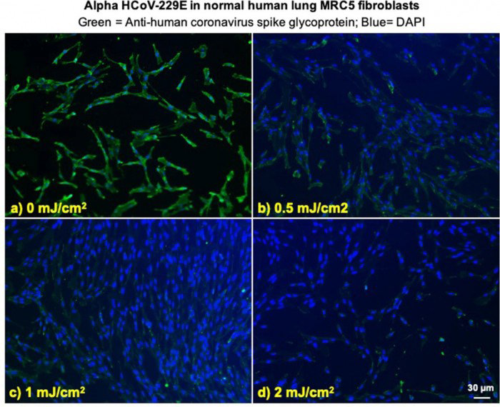 alpha Hcov 229E in normal human lung MRC5 fibroblasts